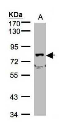 Western Blot: SHKBP1 Antibody [NBP1-31451]