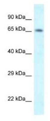 Western Blot: SHKBP1 Antibody [NBP1-82392]