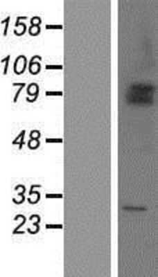 Western Blot: SHKBP1 Overexpression Lysate [NBP2-05668]