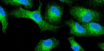 Immunocytochemistry/ Immunofluorescence: SHLD1 Antibody [NBP1-82062]