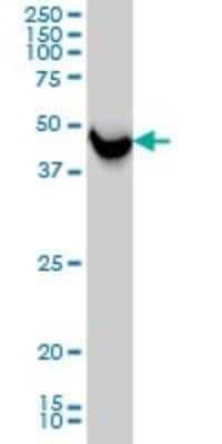 Western Blot: SHMT1 Antibody (4F9) [H00006470-M01]