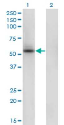 Western Blot: SHMT1 Antibody (4F9) [H00006470-M01]