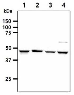 Western Blot: SHMT1 Antibody (AT26E5)BSA Free [NBP2-59437]