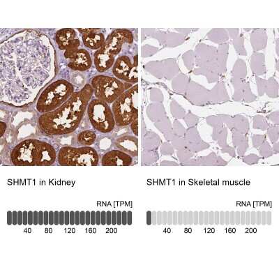 Immunohistochemistry-Paraffin: SHMT1 Antibody [NBP1-85437]