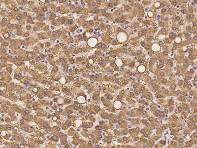 Immunohistochemistry-Paraffin: SHMT1 Antibody [NBP2-97303]