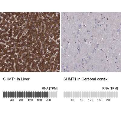 Immunohistochemistry-Paraffin: SHMT1 Antibody [NBP3-17022]