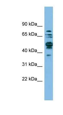 Western Blot: SHMT1 Antibody [NBP1-53192]