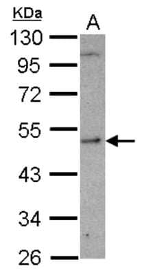 Western Blot: SHMT1 Antibody [NBP2-20353]