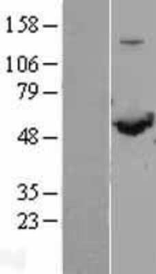 Western Blot: SHMT1 Overexpression Lysate [NBL1-15946]