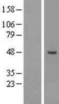 Western Blot: SHMT1 Overexpression Lysate [NBL1-15947]