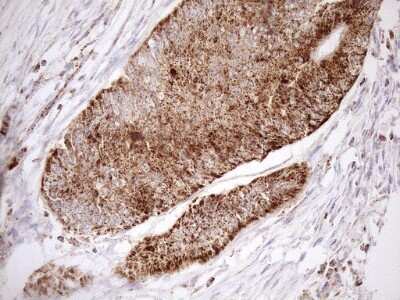Immunohistochemistry: SHMT2 Antibody (OTI3E9) [NBP2-45826]
