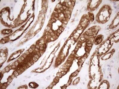 Immunohistochemistry: SHMT2 Antibody (OTI3E9) [NBP2-45826]