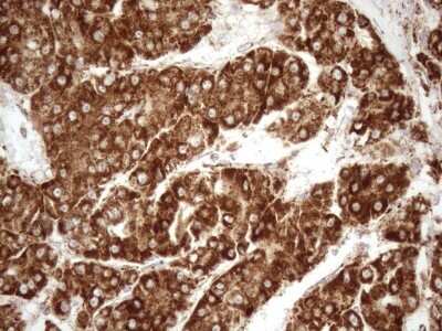 Immunohistochemistry: SHMT2 Antibody (OTI3E9) [NBP2-45826]