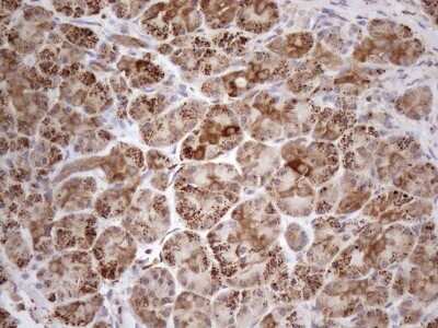 Immunohistochemistry: SHMT2 Antibody (OTI3E9) [NBP2-45826]