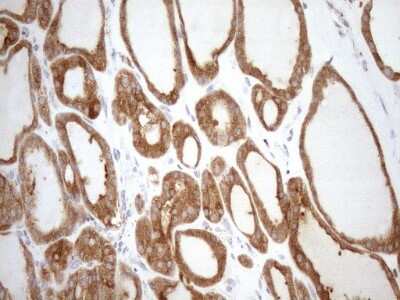 Immunohistochemistry: SHMT2 Antibody (OTI3E9) [NBP2-45826]