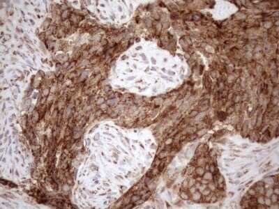 Immunohistochemistry: SHMT2 Antibody (OTI3E9) [NBP2-45826]