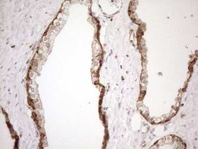 Immunohistochemistry: SHMT2 Antibody (OTI3E9) [NBP2-45826]