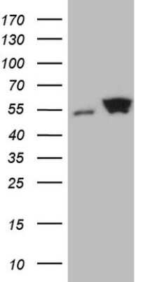 Western Blot: SHMT2 Antibody (OTI3E9) [NBP2-45826]