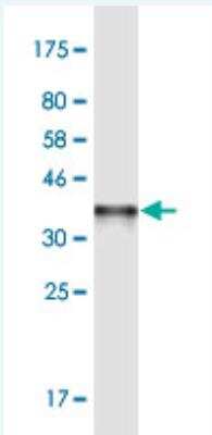 Western Blot: SHMT2 Antibody (5E7) [H00006472-M04-100ug]