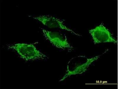 Immunocytochemistry/ Immunofluorescence: SHMT2 Antibody [H00006472-B01P]
