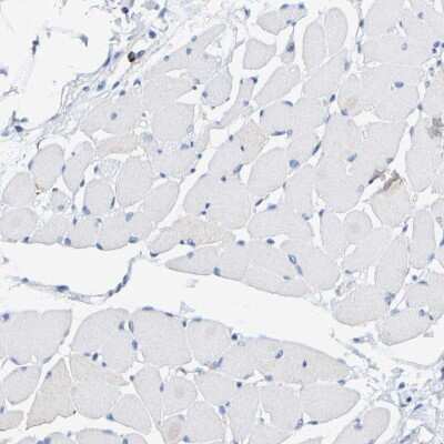 Immunohistochemistry-Paraffin: SHMT2 Antibody [NBP1-80754]