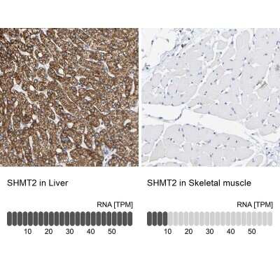 Immunohistochemistry-Paraffin: SHMT2 Antibody [NBP1-80754]