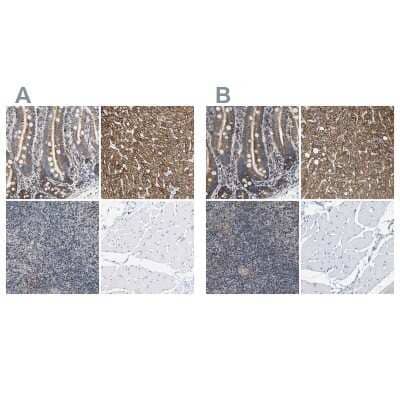 Immunohistochemistry-Paraffin: SHMT2 Antibody [NBP1-80754]