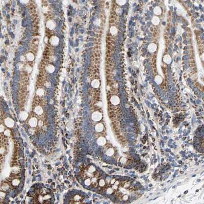 Immunohistochemistry-Paraffin: SHMT2 Antibody [NBP1-80754]