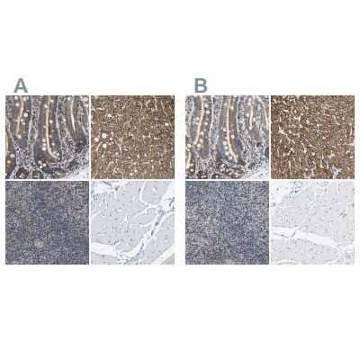 Immunohistochemistry-Paraffin: SHMT2 Antibody [NBP1-80755]