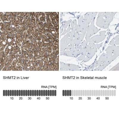 Immunohistochemistry-Paraffin: SHMT2 Antibody [NBP1-80755]