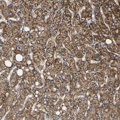 Immunohistochemistry-Paraffin: SHMT2 Antibody [NBP1-80755]