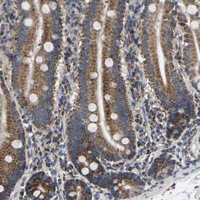 Immunohistochemistry-Paraffin: SHMT2 Antibody [NBP1-80755]