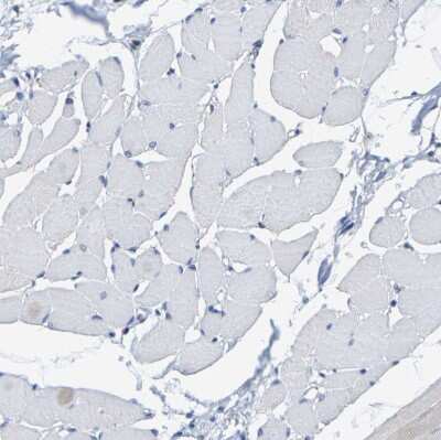 Immunohistochemistry-Paraffin: SHMT2 Antibody [NBP1-80755]