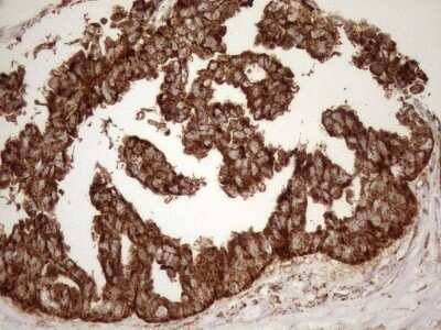 Immunohistochemistry: SHMT2 Antibody (OTI3E9) - Azide and BSA Free [NBP2-74171]