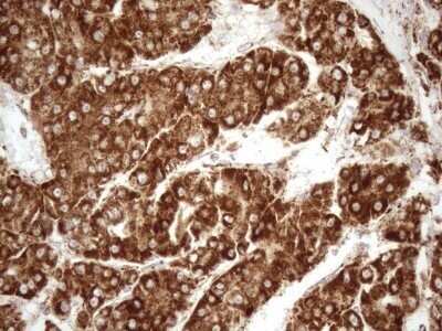 Immunohistochemistry: SHMT2 Antibody (OTI3E9) - Azide and BSA Free [NBP2-74171]