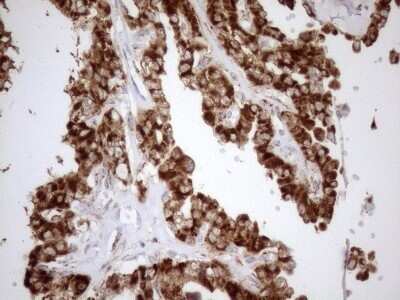 Immunohistochemistry: SHMT2 Antibody (OTI3E9) - Azide and BSA Free [NBP2-74171]