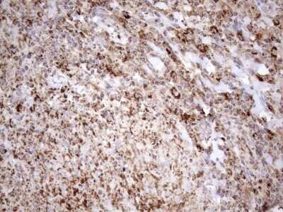 Immunohistochemistry: SHMT2 Antibody (OTI3E9) - Azide and BSA Free [NBP2-74171]
