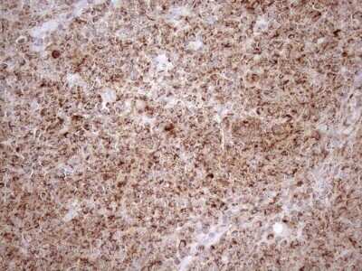 Immunohistochemistry: SHMT2 Antibody (OTI3E9) - Azide and BSA Free [NBP2-74171]