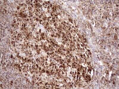 Immunohistochemistry: SHMT2 Antibody (OTI3E9) - Azide and BSA Free [NBP2-74171]
