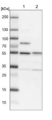 Western Blot: SHMT2 Antibody [NBP1-80754]