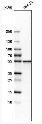Western Blot: SHMT2 Antibody [NBP1-80754]
