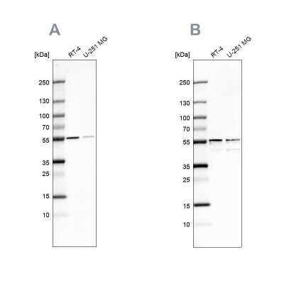 Western Blot: SHMT2 Antibody [NBP1-80754]