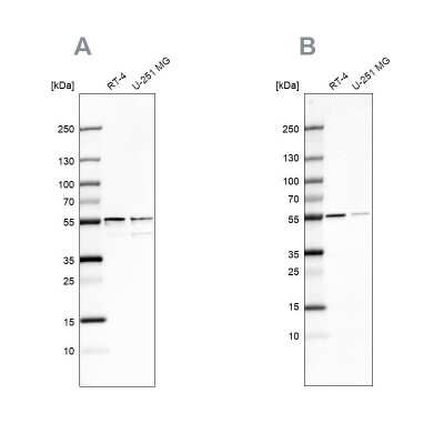 Western Blot: SHMT2 Antibody [NBP1-80755]