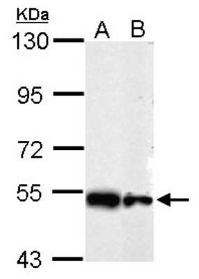 Western Blot: SHMT2 Antibody [NBP2-20354]