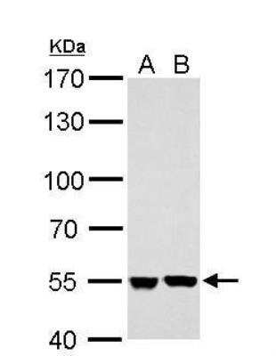 Western Blot: SHMT2 Antibody [NBP2-20354]