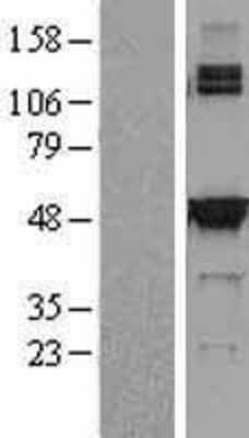 Western Blot: SHMT2 Overexpression Lysate [NBL1-15948]