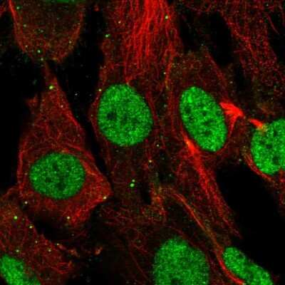 Immunocytochemistry/ Immunofluorescence: SHOX Antibody [NBP2-56369]