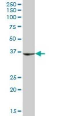 Western Blot: SHOX Antibody [H00006473-B01P]