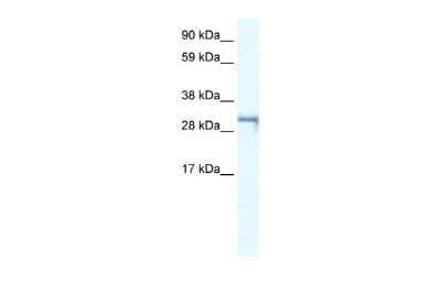 Western Blot: SHOX2 Antibody [NBP2-86806]