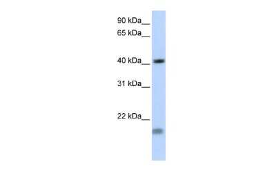 Western Blot: SHOX2 Antibody [NBP2-86807]